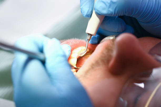 Best Emergency Treatment for Toothache in Hildebran, NC