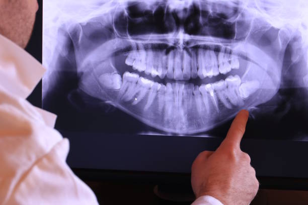 Best Weekend Emergency Dentist in Hildebran, NC