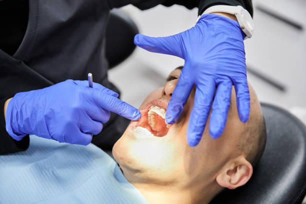 Best Emergency Tooth Extraction in Hildebran, NC