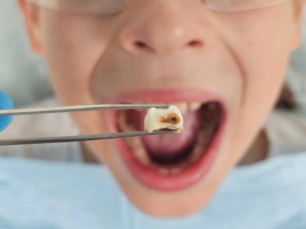 Best Urgent Dental Care in Hildebran, NC