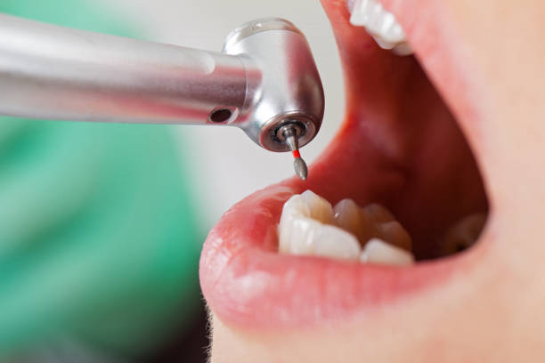 Best Emergency Broken Tooth Repair in Hildebran, NC